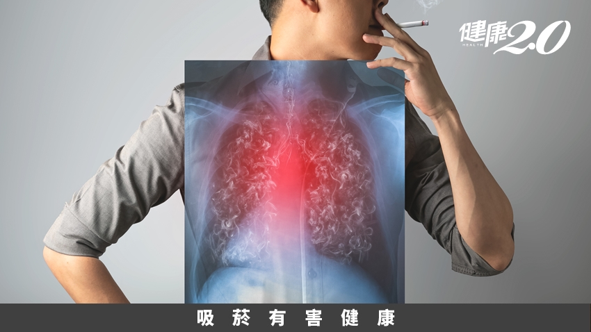 1個壞習慣染疫風險增2.14倍！戒菸靠運動、嚼口香糖無效？醫曝這招有效緩解菸癮