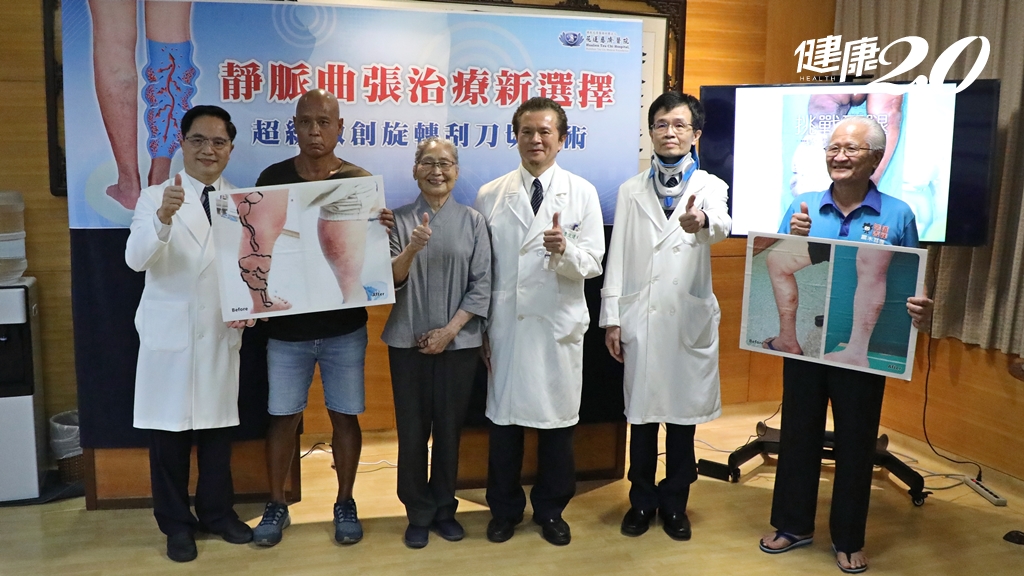 7分鐘解決靜脈曲張！醫師拿自己開刀 獨創「超級微創旋轉刮刀切除術」
