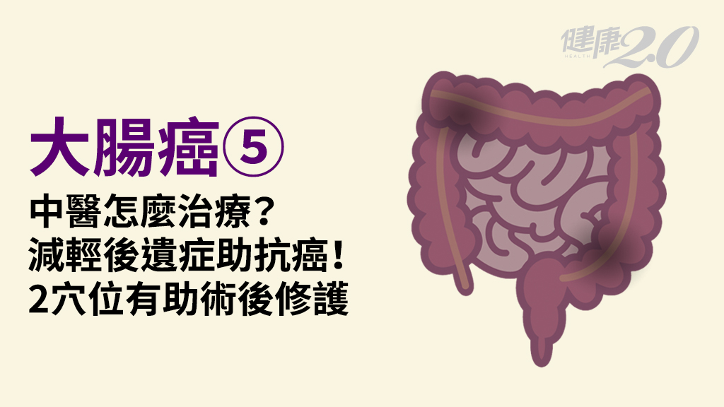 大腸癌／中醫「化瘀解毒」輔助抗癌！飲食調理防息肉 癌友按2穴助術後修護