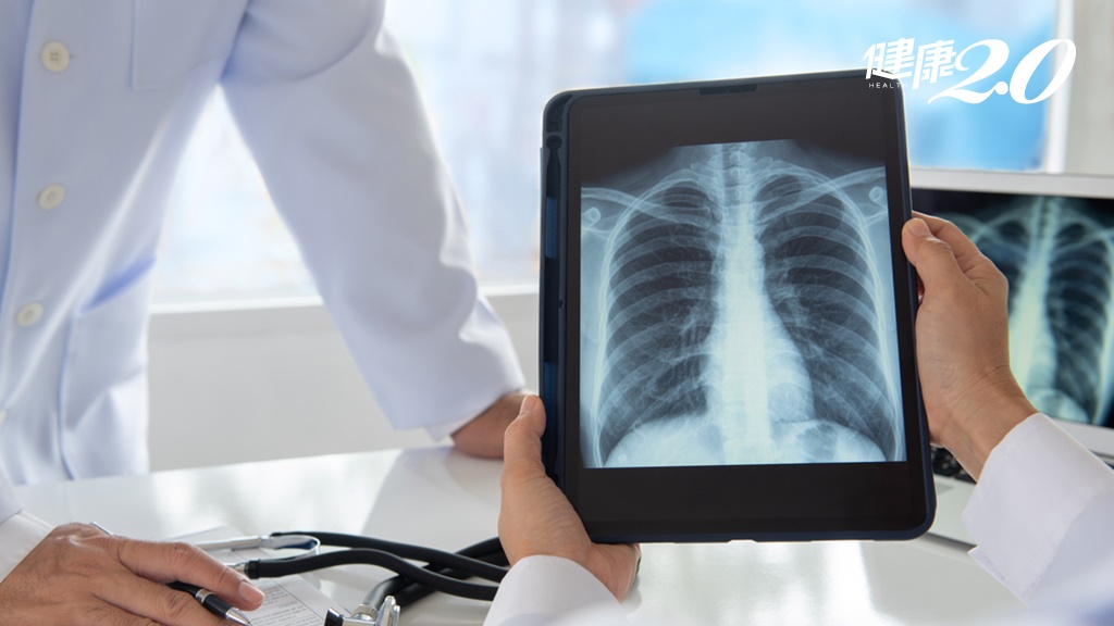 台灣每6人就有1人因肺病死亡！3大預防措施及早揪肺癌 降低死亡風險