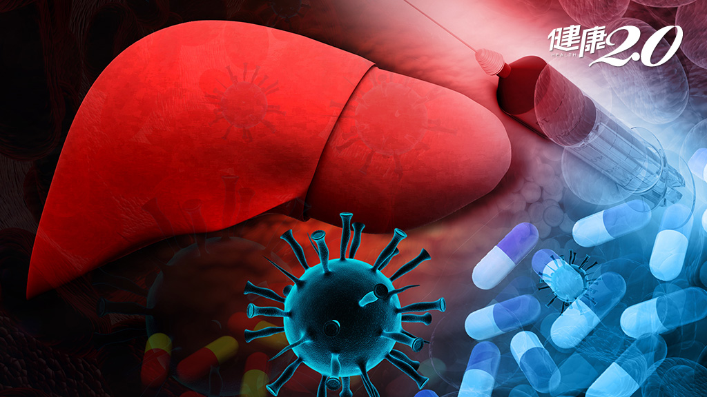 感染C型肝炎不只傷肝！恐引全身發炎釀多種併發症 多數人不知罹病、預防快做這件事