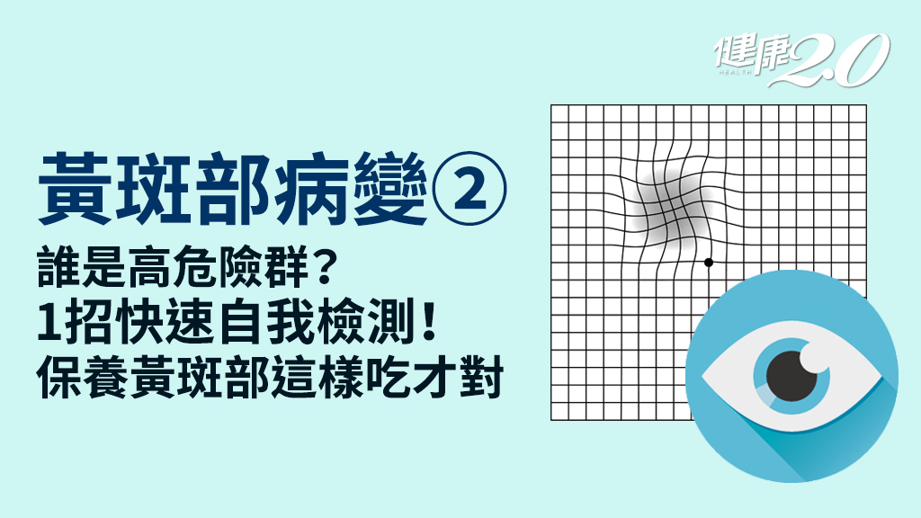 黃斑部病變／哪些人容易有黃斑部病變？1張表快速自測 6類護眼食物要多吃