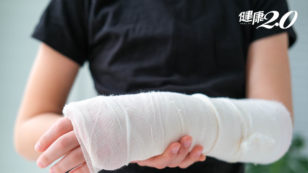 骨折吃什麼才好的快？這4種營養素不能少！想快點拆石膏這樣吃才對