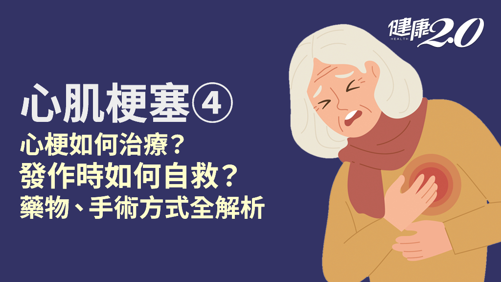 心肌梗塞／心梗會好嗎？如何救治？藥物、心導管、自救法一次看