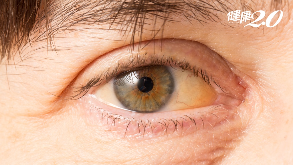 Search result thumbnail