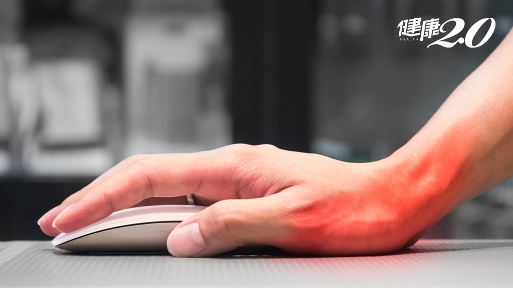 滑鼠手懶人包！手指無力、刺痛 3症狀可能是滑鼠手 好發族群靠3招可改善