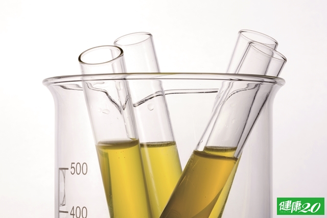 自我檢測 腎好不好關鍵５徵兆